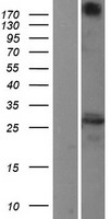 TMP21 (TMED10) Human Over-expression Lysates NM_006827