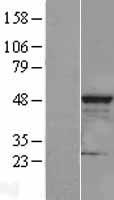 HEAB (CLP1) Human Over-expression Lysates NM_006831