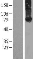 Kindlin 2 (FERMT2) Human Over-expression Lysates NM_006832