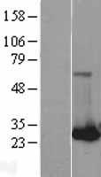 RAB32 Human Over-expression Lysates NM_006834