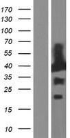 EB2 (MAPRE2) Human Over-expression Lysates NM_001143826