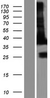EB2 (MAPRE2) Human Over-expression Lysates NM_001143827