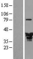 EB2 (MAPRE2) Human Over-expression Lysates NM_014268