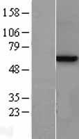 Methionine Aminopeptidase 2 (METAP2) Human Over-expression Lysates NM_006838