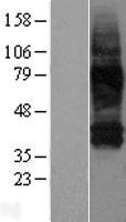 ls010991 slc38a3 human over expression lysates nm 006841 wb testing 1