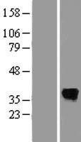 SDS Human Over-expression Lysates NM_006843
