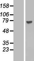 FATP2 (SLC27A2) Human Over-expression Lysates NM_003645