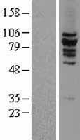 MCAK (KIF2C) Human Over-expression Lysates NM_006845
