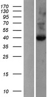 GLIPR1 Human Over-expression Lysates NM_006851