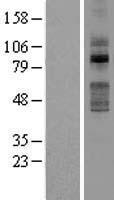 TLK2 Human Over-expression Lysates NM_006852