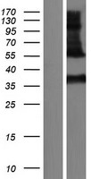 Kallikrein 11 (KLK11) Human Over-expression Lysates NM_001167605