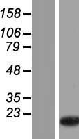 TMSB15A Human Over-expression Lysates NM_021992