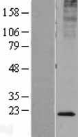 KDELR2 Human Over-expression Lysates NM_006854