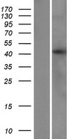ls011019 lias human over expression lysates nm 006859 wb testing 1