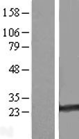 RAB35 Human Over-expression Lysates NM_006861