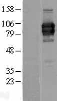 ls011027 lilra2 human over expression lysates nm 006866 wb testing 1