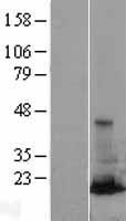 ls011031 rab31 human over expression lysates nm 006868 wb testing 1
