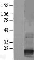 Destrin (DSTN) Human Over-expression Lysates NM_006870