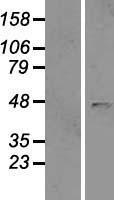 B4GAT1 Human Over-expression Lysates NM_006876