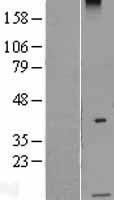 ls011042 gusbp15 human over expression lysates nm 021036 wb testing 1