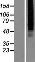 TRF41 (PAPD7) Human Over-expression Lysates NM_006999