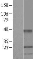 Uroplakin Ia (UPK1A) Human Over-expression Lysates NM_007000