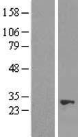 NUDT21 Human Over-expression Lysates NM_007006
