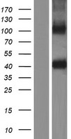 ls011055 zpbp1 zpbp human over expression lysates nm 001159878 wb testing 2