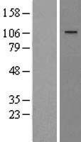 WWP1 Human Over-expression Lysates NM_007013