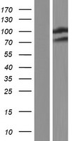WWP2 Human Over-expression Lysates NM_007014