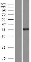 WWP2 Human Over-expression Lysates NM_199423