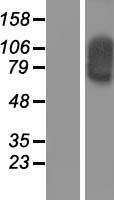 SOX30 Human Over-expression Lysates NM_178424