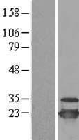 ls011065 ube2c human over expression lysates nm 007019 wb testing 1