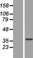 ls011066 u1snrnpbp snrnp35 human over expression lysates nm 180699 wb testing 2