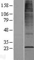 CYB561D2 Human Over-expression Lysates NM_007022