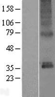 ls011070 pl6 tmem115 human over expression lysates nm 007024 wb testing 1