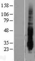 DUSP14 Human Over-expression Lysates NM_007026