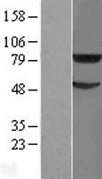 TRIM31 Human Over-expression Lysates NM_007028