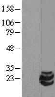 STMN2 Human Over-expression Lysates NM_007029