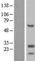 Tubulin Polymerization Promoting Protein (TPPP) Human Over-expression Lysates NM_007030