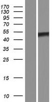 TRIOBP Human Over-expression Lysates NM_138632