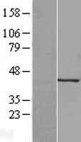 Keratocan (KERA) Human Over-expression Lysates NM_007035