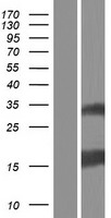 ESM1 Human Over-expression Lysates NM_001135604
