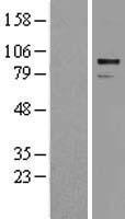 ADAM30 Human Over-expression Lysates NM_021794