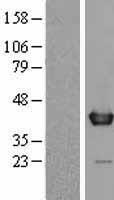 WDR5 Human Over-expression Lysates NM_017588