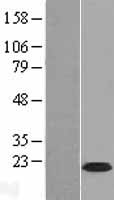 C9orf7 (CACFD1) Human Over-expression Lysates NM_017586