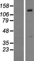 PTPD1 (PTPN21) Human Over-expression Lysates NM_007039
