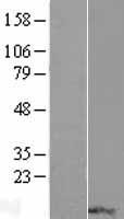 RPP14 Human Over-expression Lysates NM_001098783