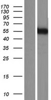 KATNA1 Human Over-expression Lysates NM_007044