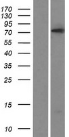 PRDM5 Human Over-expression Lysates NM_018699